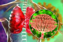 Illustration of a pulmonary aspergillosis, invasion of a lung tissue by mold fungi Aspergillus with close-up view of the fungi.