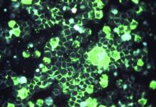 This is the photomicrographic detection of respiratory syncytial virus using indirect immunofluorescence technique.