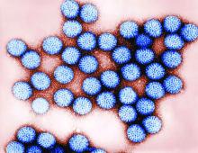 A transmission electron micrograph shows intact rotavirus double-shelled particles.