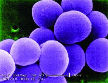 This scanning electron micrograph (SEM) shows a strain of Staphylococcus aureus bacteria taken from a vancomycin intermediate resistant culture.