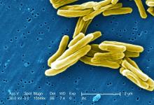 Gram-positive Mycobacterium tuberculosis bacteria is shown.
