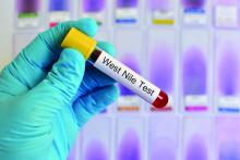 Blood sample in tube to test for West nile virus.