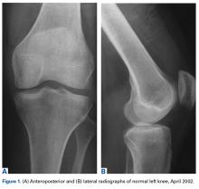 Figure 1.  Figure 1.