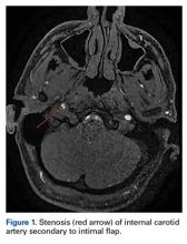 Figure 1.  Figure 1.