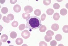 Figure 1. A large granular lymphocyte.