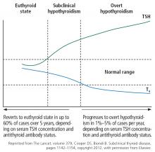 Natural course of subclinical hypothyroidism