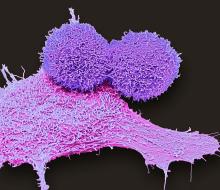 illustsration of breast cancer cells