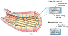 Components of drug-eluting and bioresorbable stents