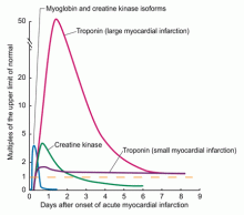 Time of release of selected cardiac biomarkers after MI