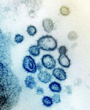 This transmission electron microscope image shows SARS-CoV-2—also known as 2019-nCoV, the virus that causes COVID-19—isolated from a patient in the U.S. Virus particles are shown emerging from the surface of cells cultured in the lab.