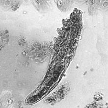 A higher density of Demodex mites on the skin may play a role in the development of papules and pustules associated with rosacea, mounting evidence suggests.