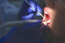 A dentist works on a patient's teeth