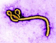 Colorized transmission electron micrograph (TEM) revealing some of the ultrastructural morphology displayed by an Ebola virus virion.
