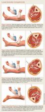 Lower extremity compartments