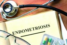 endometriosis