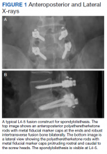 Anteroposterior and Lateral X-rays figure