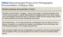 Recommended Protocol for Photographic Documentation of Biopsy Sites