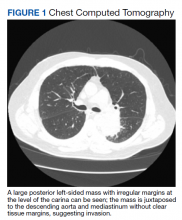 Chest Computed Tomography figure 