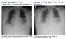 Chest X-ray First Presentation to Emergency Department and Chest X-ray First Hospital Discharge figures