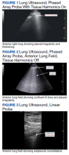 Lung Ultrasound, Phased Array Probe figures