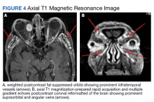 Axial T1 Magnetic Resonance Image