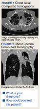 Chest Axial Computed Tomography and Chest Coronal Computed Tomography