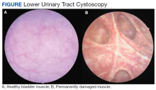 Lower Urinary Tract Cystoscopy