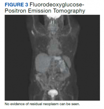 Fluorodeoxyglucose- Positron Emission Tomography