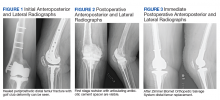 Lateral Radiographs