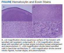 Hematoxylin and Eosin Stains