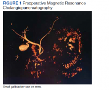 Preoperative Magnetic Resonance Cholangiopancreatography