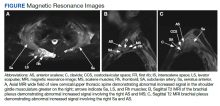 Magnetic Resonance Images