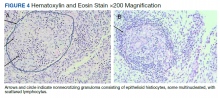 Hematoxylin and Eosin Stain ×200 Magnification