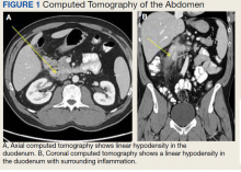 Computed Tomography of the Abdomen