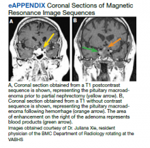 Coronal Sections of Magnetic Resonance Image Sequences