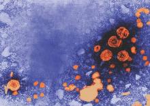 Hepatitis B vaccine response suppressed by maternal antibodies | MDedge ...