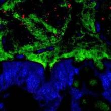 This photo shows bacteria that are present deeper in the mucus layer that lines the intestine and closer to the epithelium than they should be.