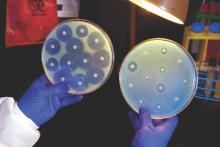 A CDC microbiologist holds up a petri dish, on the right, inoculated with a carbapenem-resistant Enterobacteriaceae (CRE) bacterium that proved to be resistant to all of the antibiotics tested.