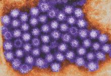 This transmission electron micrograph (TEM) reveals norovirus virions, or virus particles.