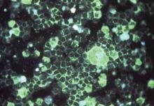 This is the photomicrographic detection of respiratory syncytial virus (RSV) using indirect immunofluorescence technique. RSV is the most common cause of bronchiolitis and pneumonia among infants and children under 1 year of age. 