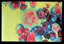 Shown are HIV-Infected T cells.
