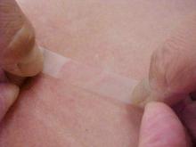Simple cellophane tape can be used to diagnose microorganisms that infect the skin. 