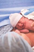 Early skin-to-skin contact is typically encouraged as part of a gentle cesarean.
