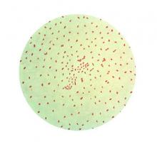 Dr. Tracy A. Lieu said, “Nonmedical exemptions from immunization in California clustered geographically and were associated with clusters of pertussis cases.”