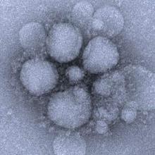 MERS-CoV particles as seen by negative stain electron microscopy. Virions contain characteristic club-like projections emanating from the viral membrane.