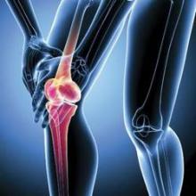 Intra-articular treatments may be more effective than oral therapies for knee osteoarthritis.