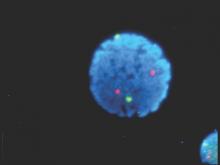 Human lymphocyte nucleus stained with DAPI with chromosome 13 (green) and 21 (red) centromere probes hybrydized (FISH).