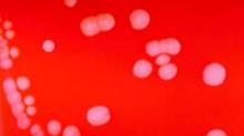 Pictured are Neisseria meningitidis colonies, which can cause meningitis and other forms of meningococcal disease.