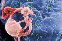 Scanning electron micrograph of HIV-1 budding from cultured lymphocyte. 