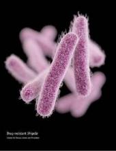 Shigella sonnei